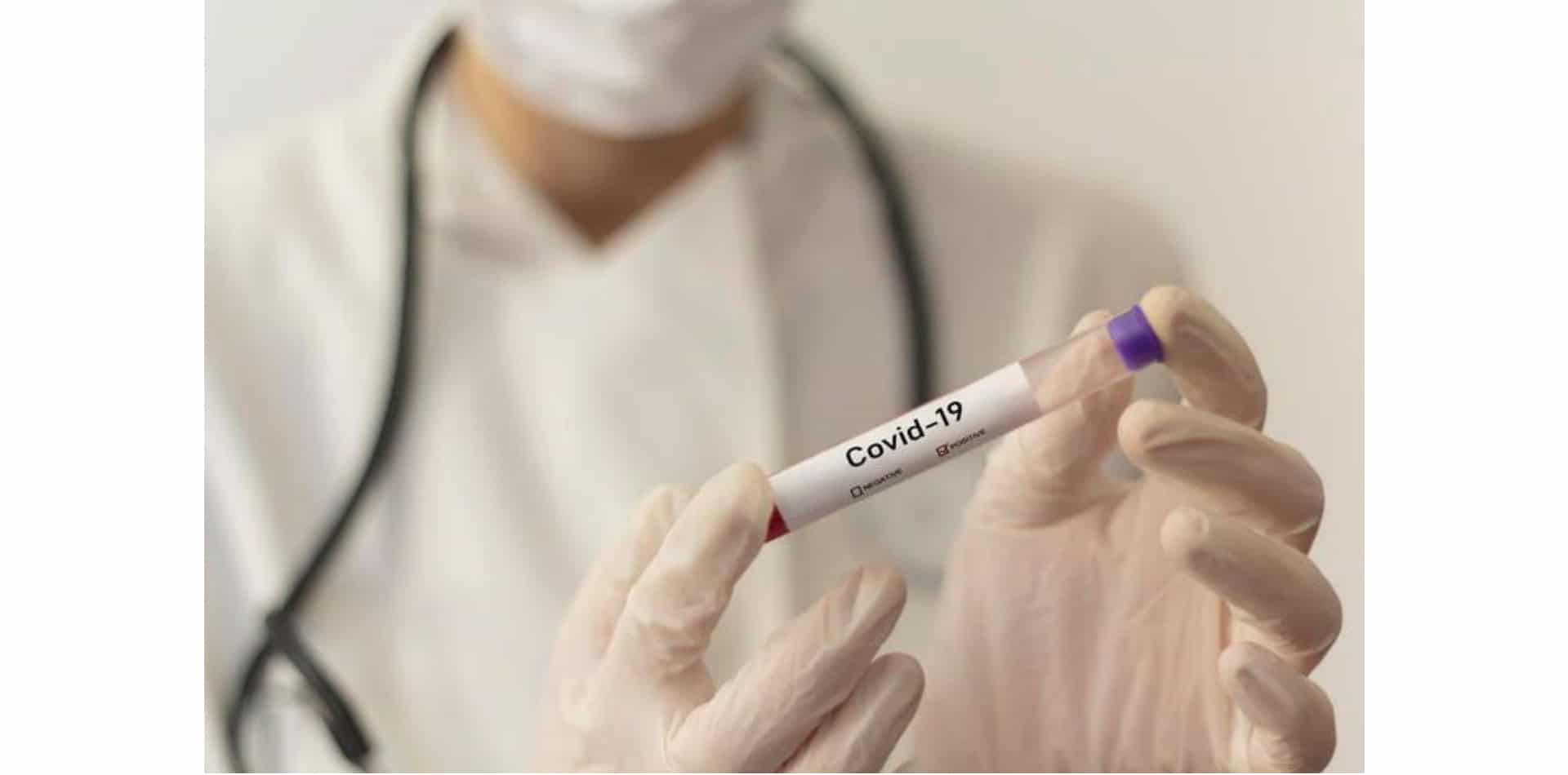 Los profesionales del cannabis opinan sobre cómo afectará al sector la pandemia de coronavirus